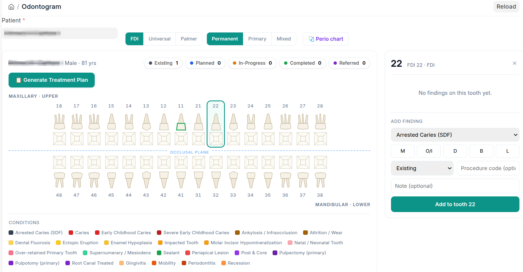 Odontogram: a full-mouth chart with per-tooth findings, notation and dentition switches, a condition legend and a panel for adding a finding to the selected tooth.